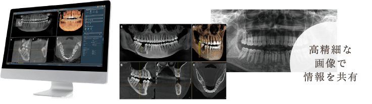高精細な画像で情報を共有