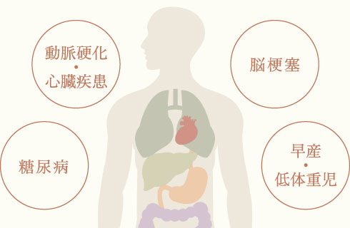 糖尿病・動脈硬化・心臓疾患・脳梗塞早産・低体重児